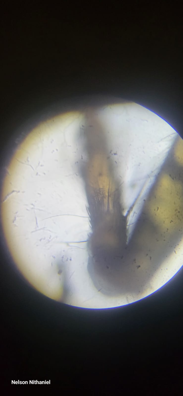 Wings, Legs and Lenses: Grade 10's Pooter Insect Investigation at bms